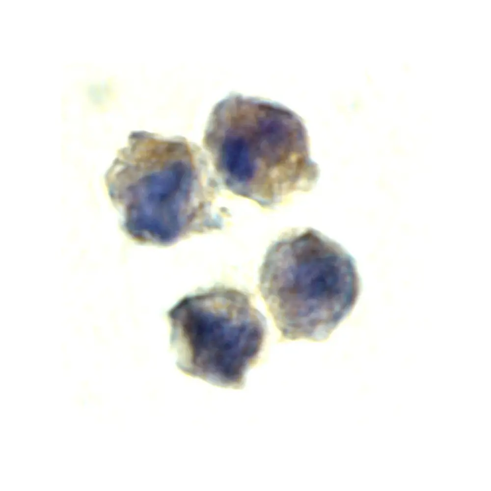 ProSci 2497 IL-22 Receptor Antibody, ProSci, 0.1 mg/Unit Quaternary Image
