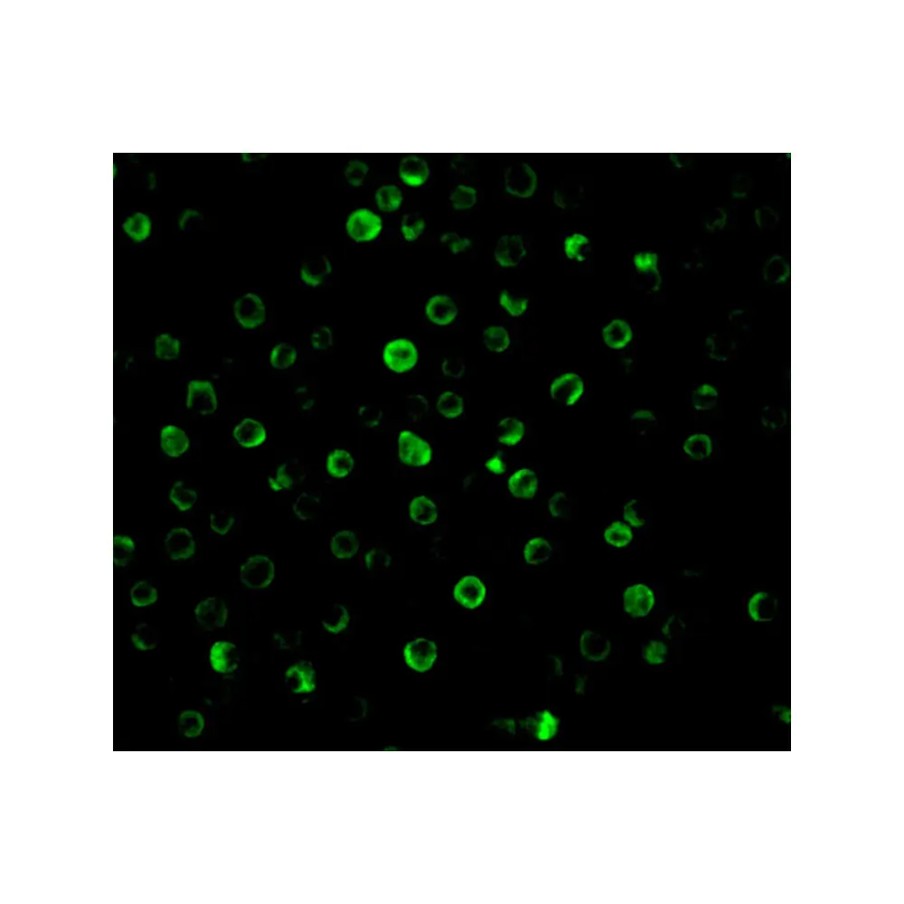 ProSci 2497 IL-22 Receptor Antibody, ProSci, 0.1 mg/Unit Tertiary Image