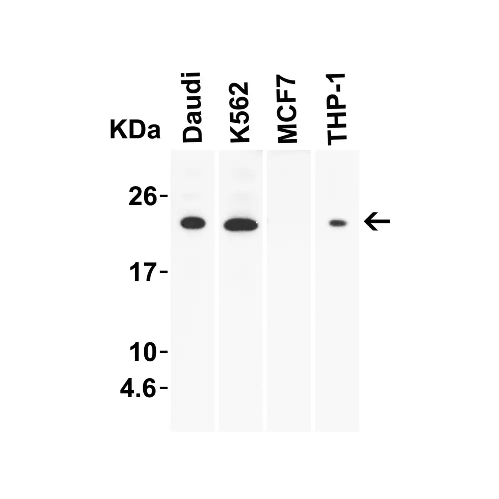 ProSci 3793_S IL-23 Antibody, ProSci, 0.02 mg/Unit Secondary Image