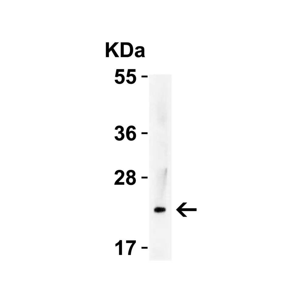 ProSci 3793_S IL-23 Antibody, ProSci, 0.02 mg/Unit Tertiary Image