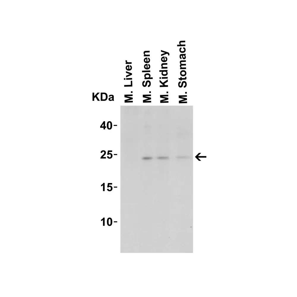 ProSci 3795_S IL-23 Antibody, ProSci, 0.02 mg/Unit Tertiary Image