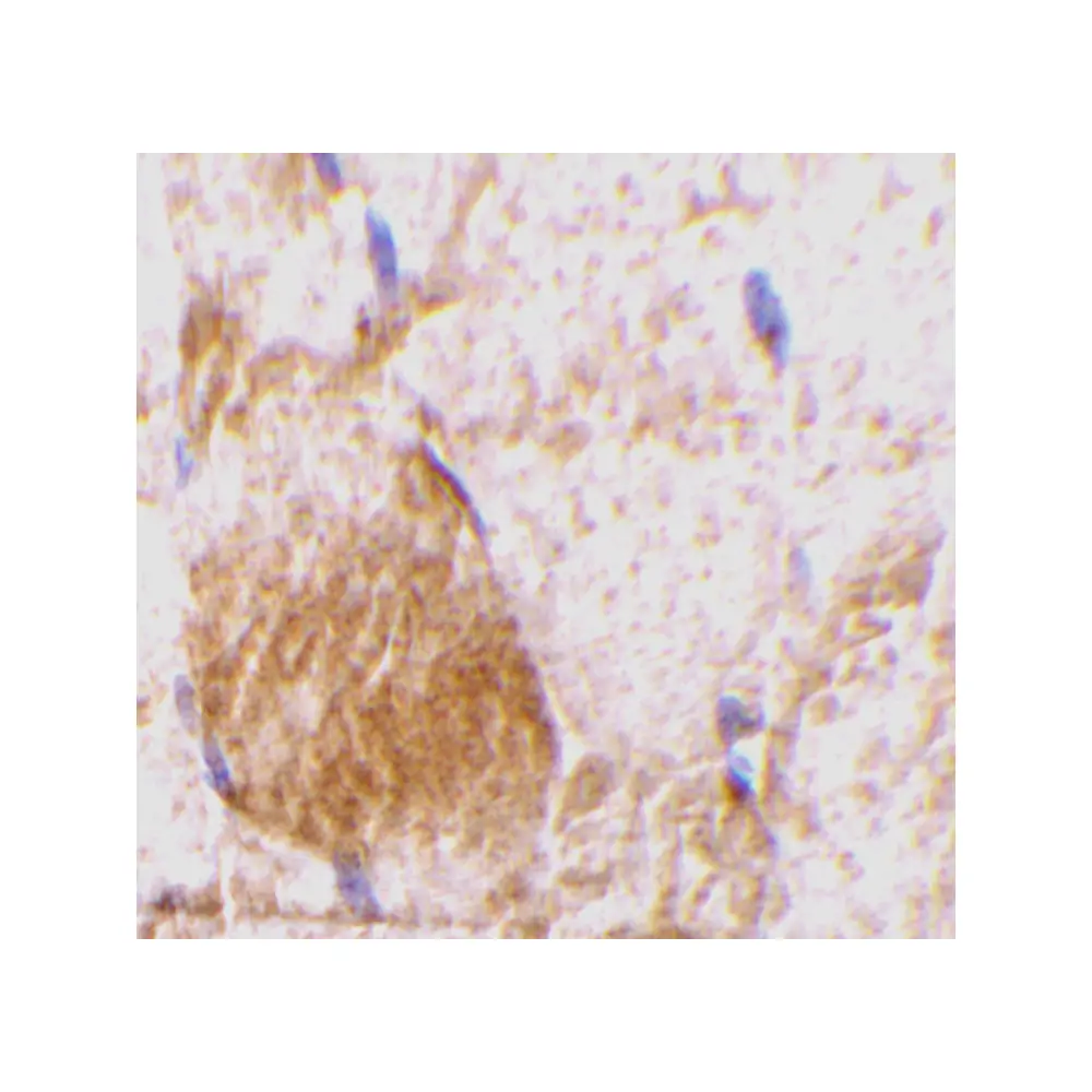 ProSci 3745 IL-31 Antibody, ProSci, 0.1 mg/Unit Secondary Image