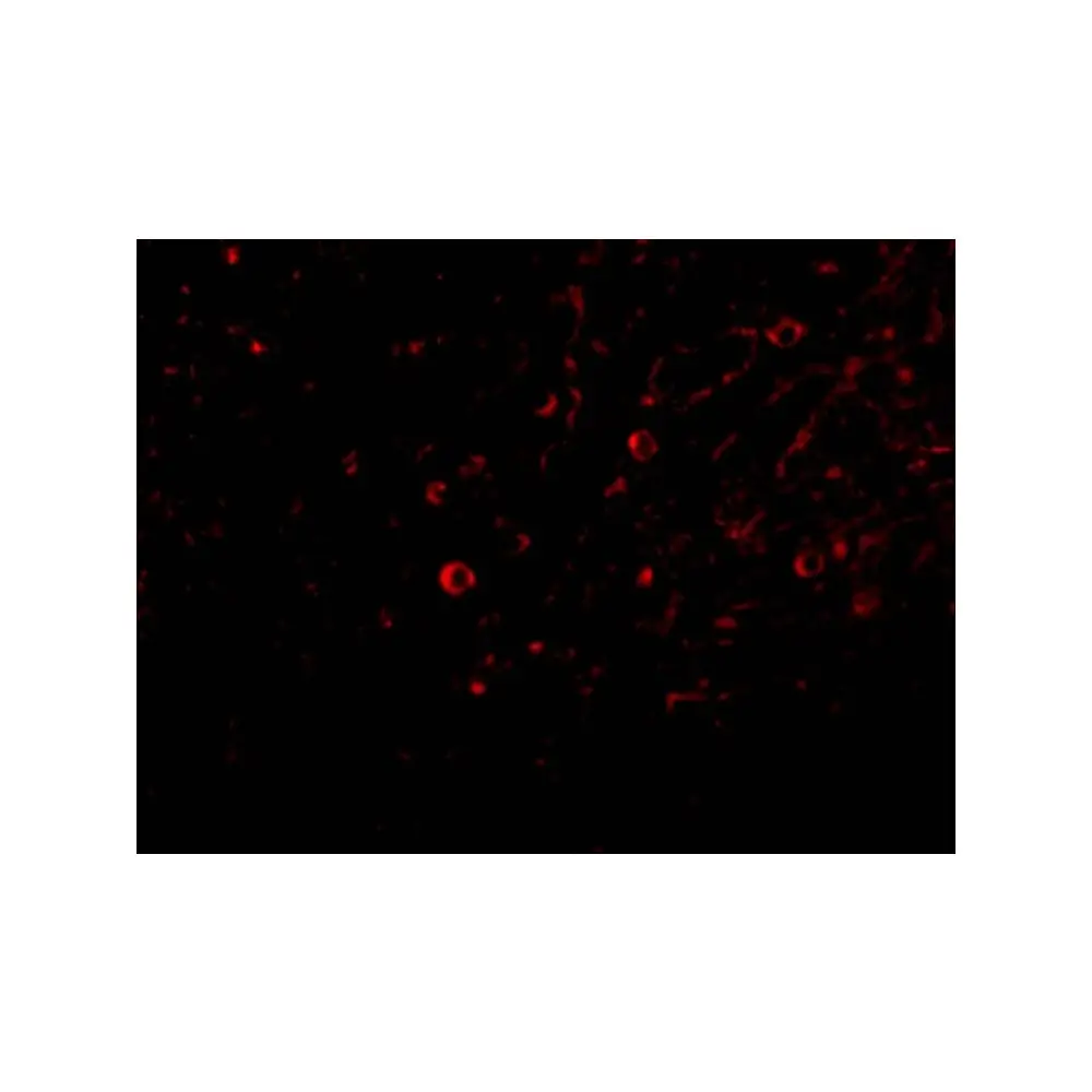 ProSci 3749 IL-32 Antibody, ProSci, 0.1 mg/Unit Quaternary Image
