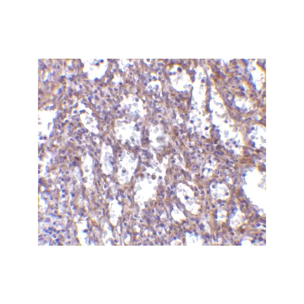 ProSci 3749 IL-32 Antibody, ProSci, 0.1 mg/Unit Tertiary Image