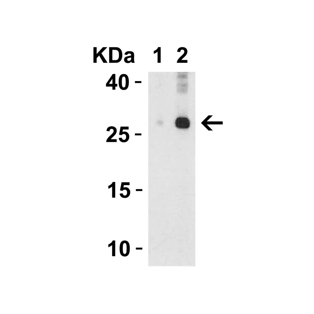 ProSci 3749_S IL-32 Antibody, ProSci, 0.02 mg/Unit Secondary Image