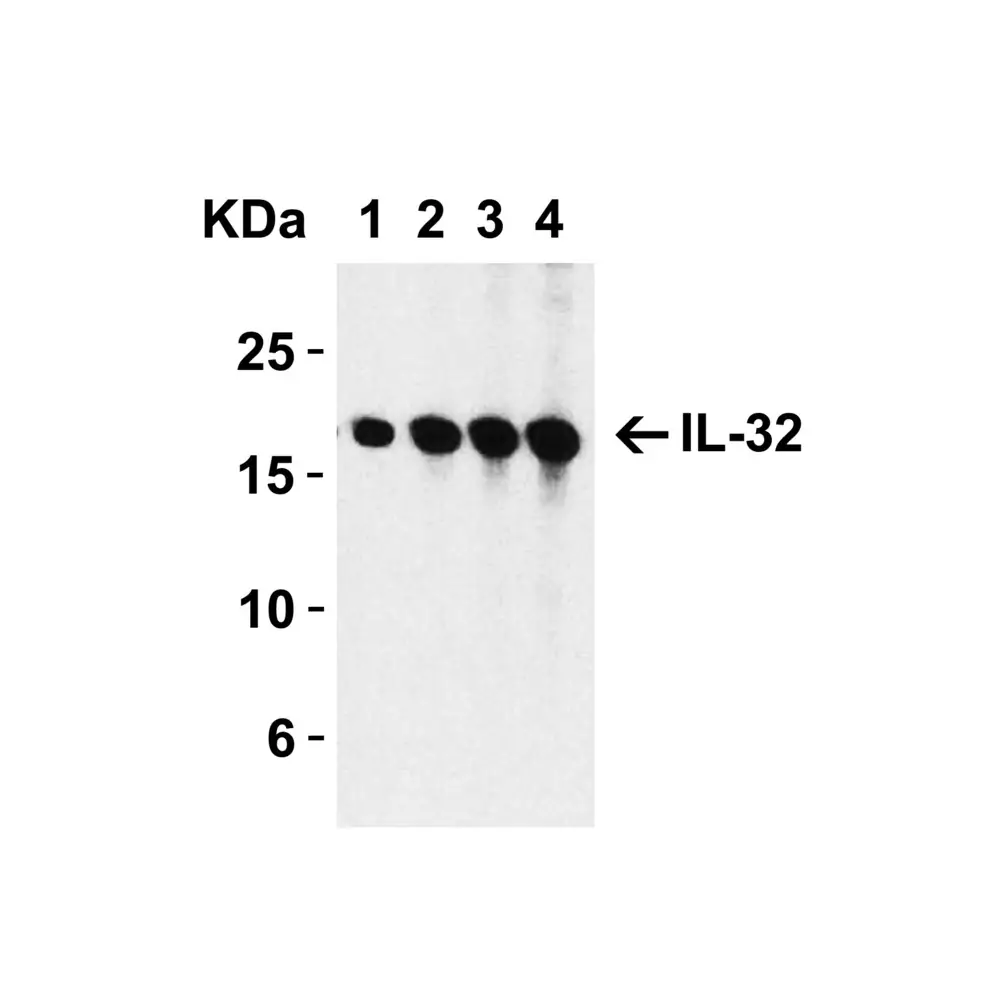 ProSci 3751 IL-32 Antibody, ProSci, 0.1 mg/Unit Primary Image