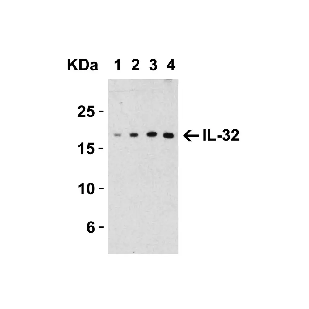 ProSci 3749_S IL-32 Antibody, ProSci, 0.02 mg/Unit Primary Image