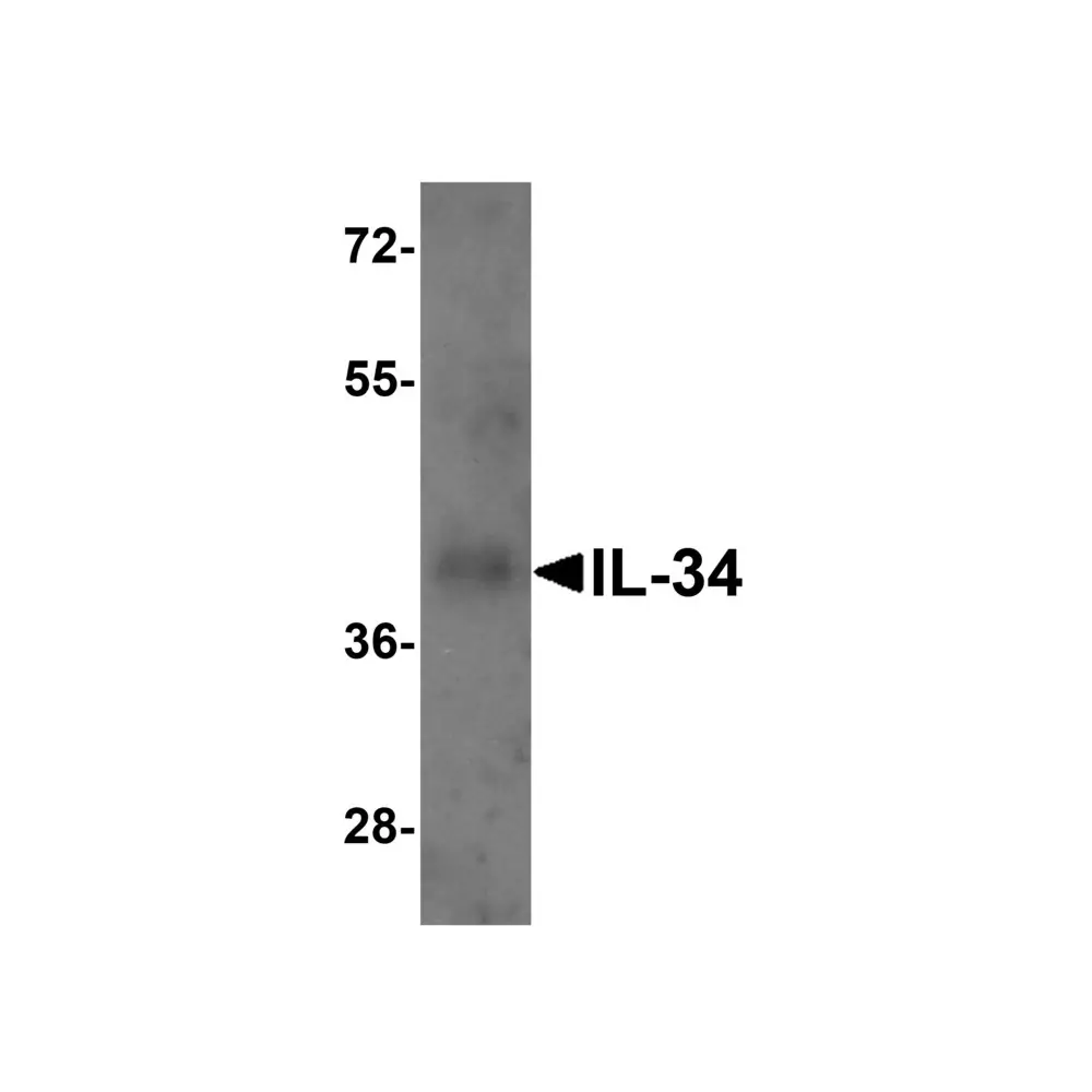 ProSci 4779_S IL-34 Antibody, ProSci, 0.02 mg/Unit Secondary Image