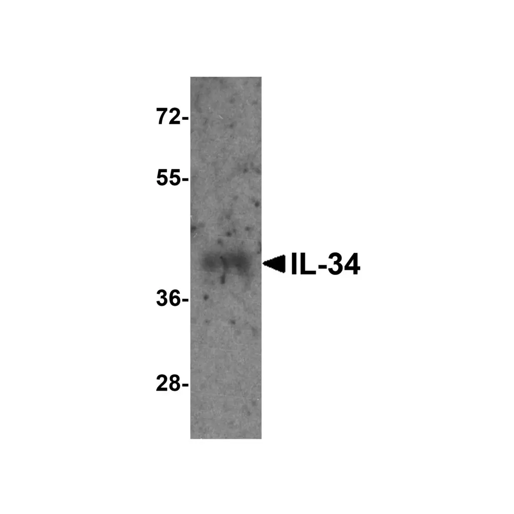 ProSci 4781_S IL-34 Antibody, ProSci, 0.02 mg/Unit Secondary Image