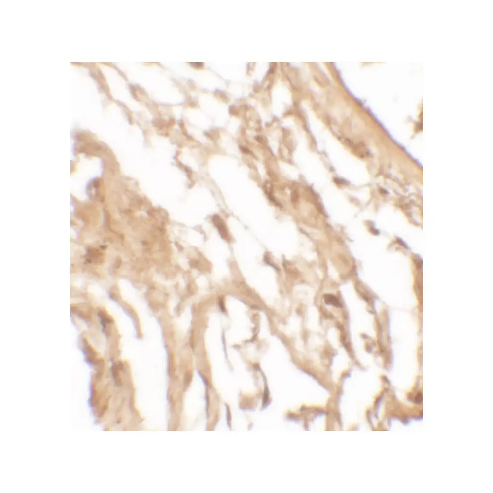 ProSci 7499 IL-37 Antibody , ProSci, 0.1 mg/Unit Secondary Image