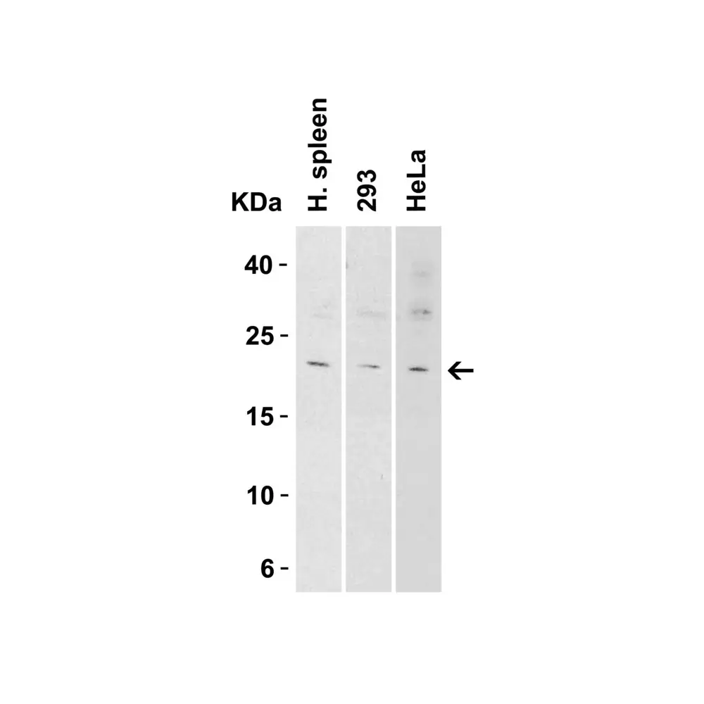 ProSci 7495 IL-9 Antibody , ProSci, 0.1 mg/Unit Tertiary Image
