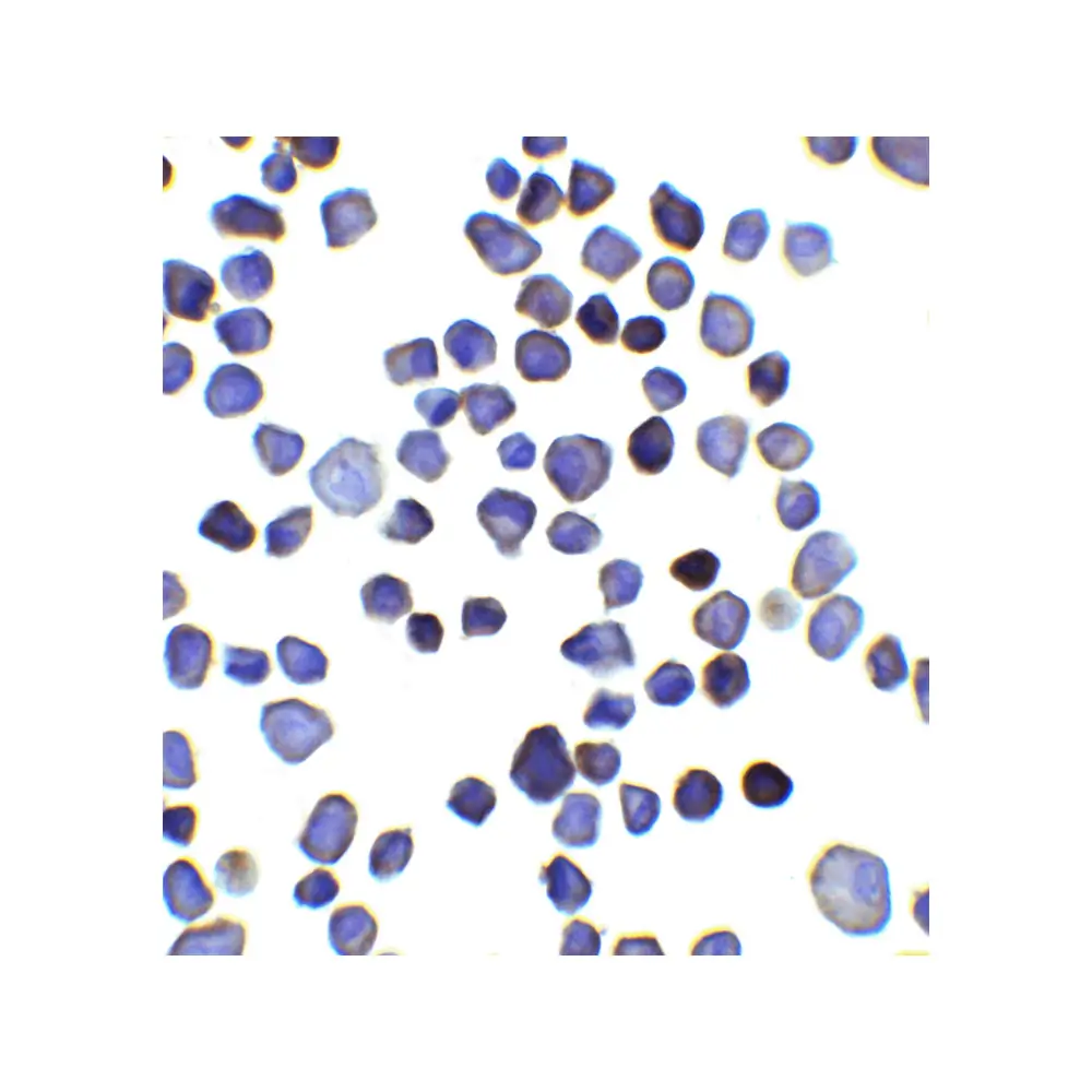 ProSci 8339 INPP4B Antibody, ProSci, 0.1 mg/Unit Secondary Image