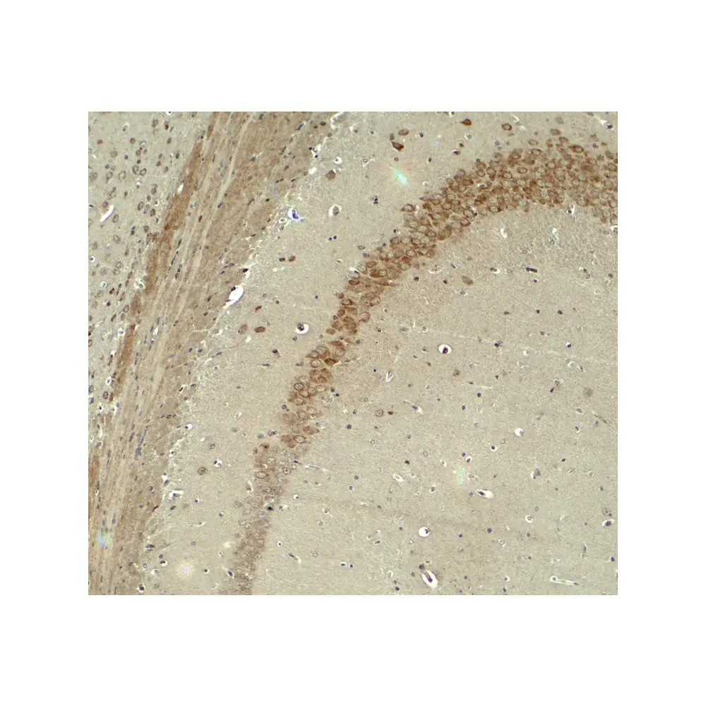 ProSci 8011_S IQSEC2 Antibody, ProSci, 0.02 mg/Unit Secondary Image