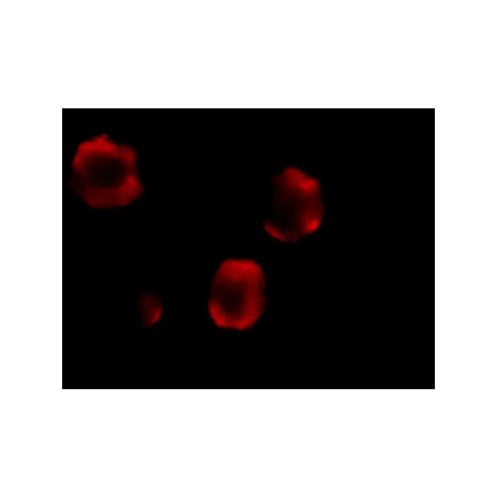 ProSci 2123_S IRAK-2 Antibody, ProSci, 0.02 mg/Unit Tertiary Image