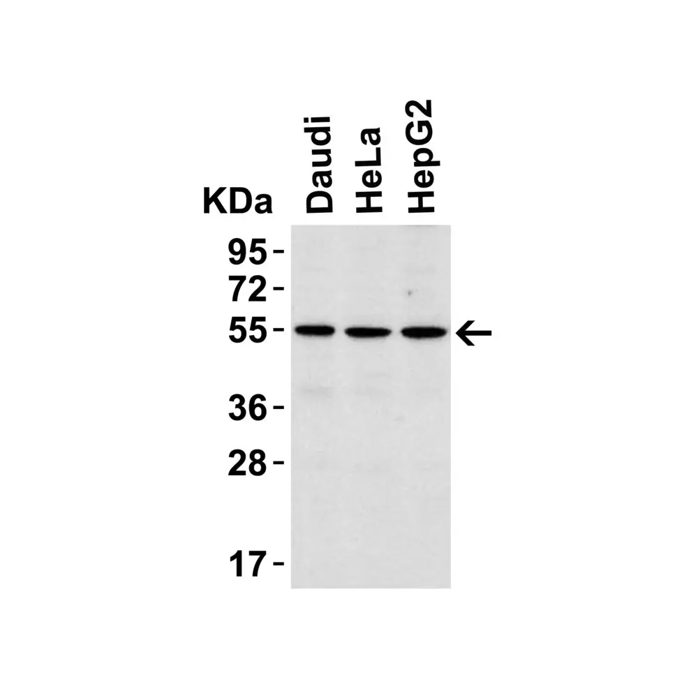 ProSci 3125 IRAK-4 Antibody, ProSci, 0.1 mg/Unit Primary Image