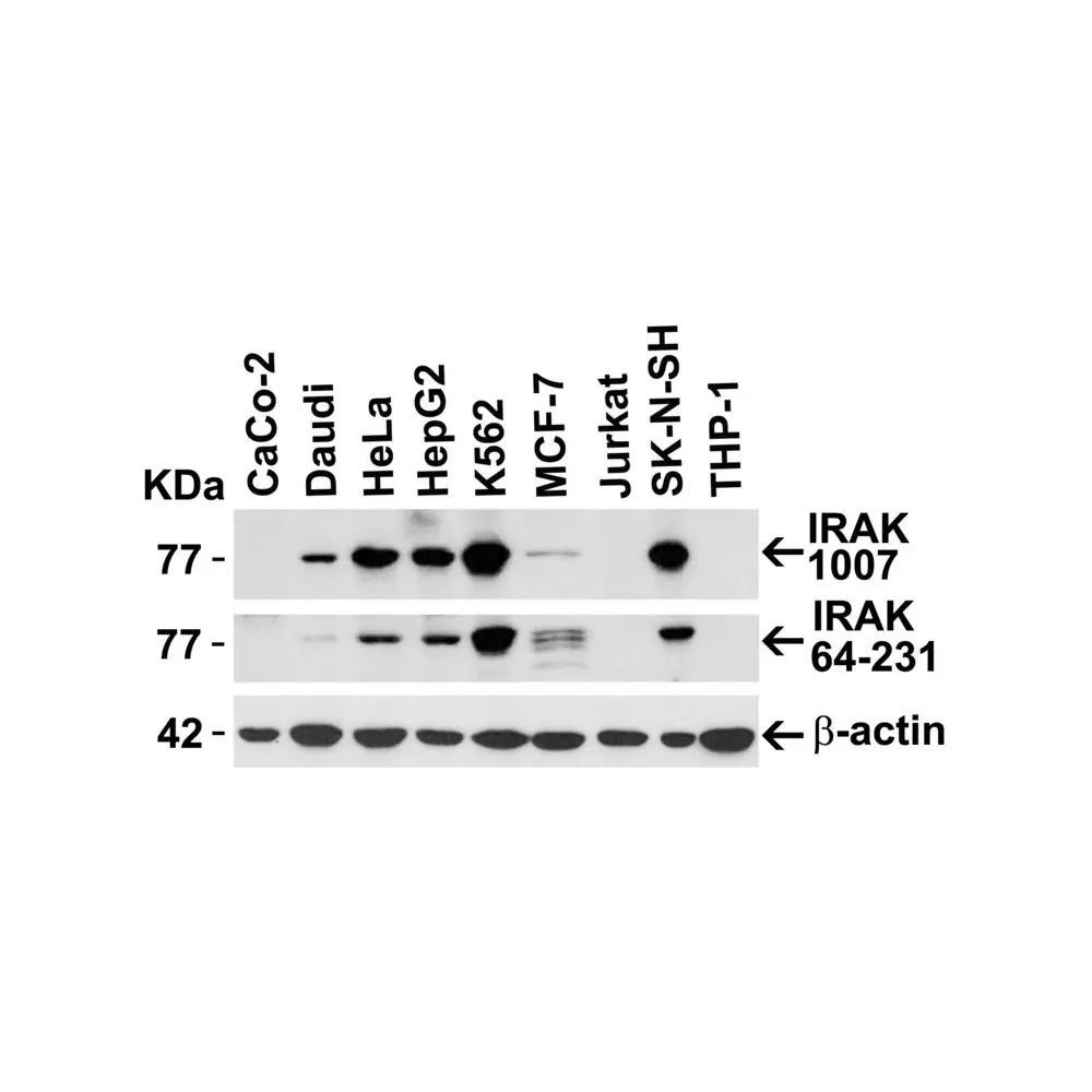 ProSci 1007_S IRAK Antibody, ProSci, 0.02 mg/Unit Secondary Image