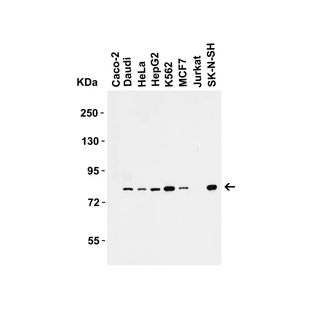 ProSci 1007_S IRAK Antibody, ProSci, 0.02 mg/Unit Primary Image