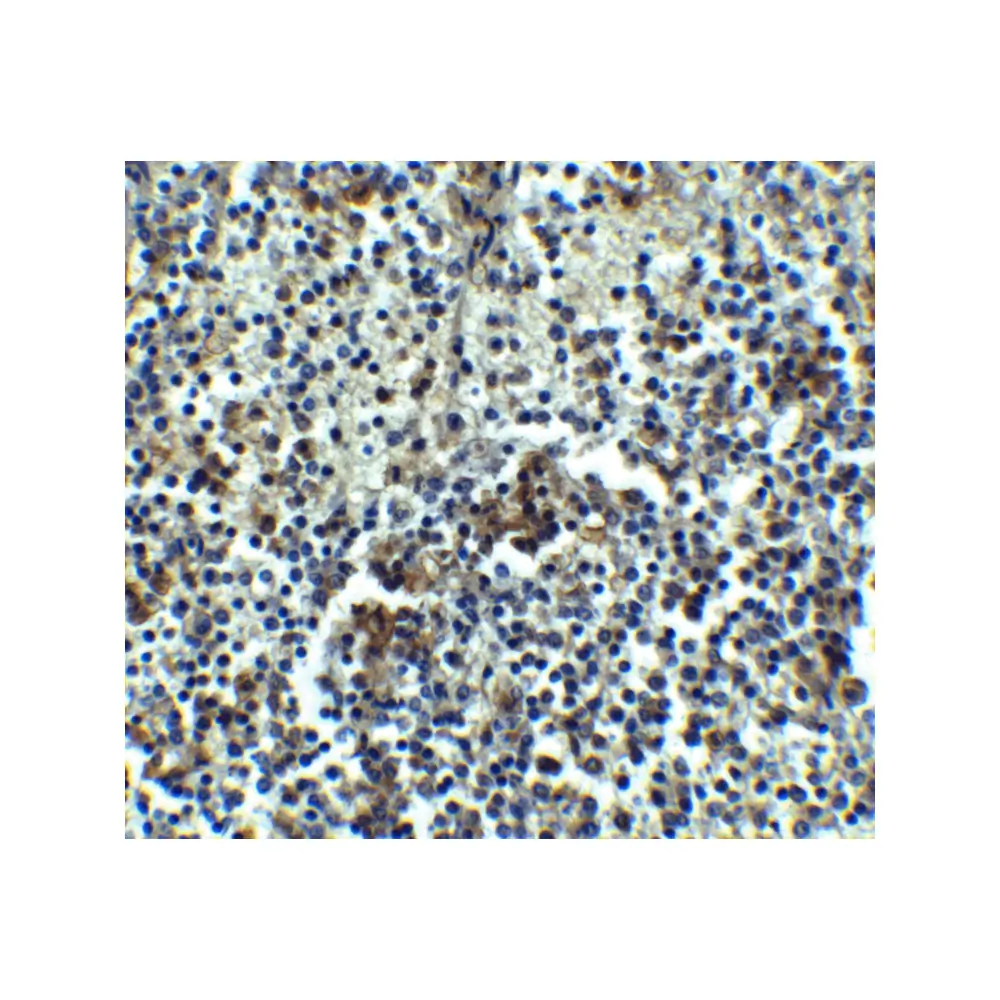 ProSci 2355 IRAK-M Antibody, ProSci, 0.1 mg/Unit Secondary Image