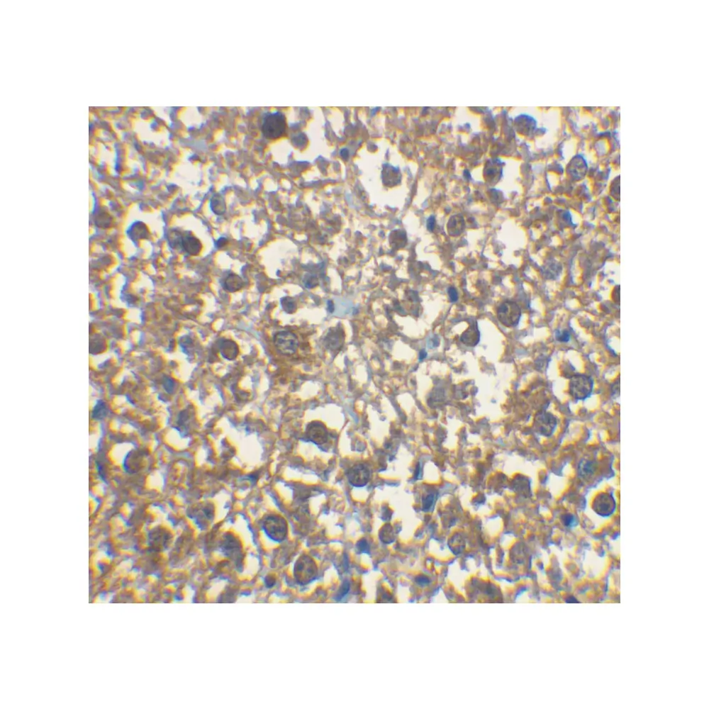 ProSci 2355_S IRAK-M Antibody, ProSci, 0.02 mg/Unit Quaternary Image