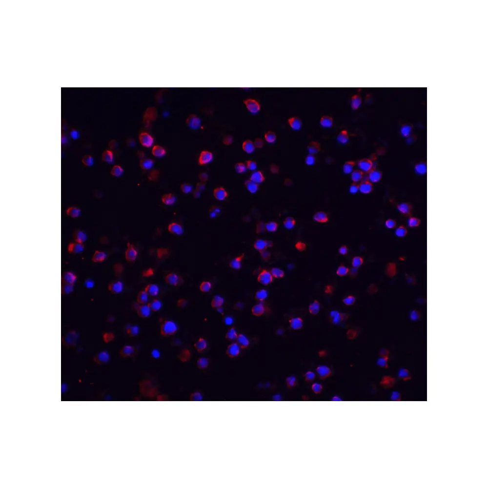 ProSci 2123 IRAK-2 Antibody, ProSci, 0.1 mg/Unit Quaternary Image