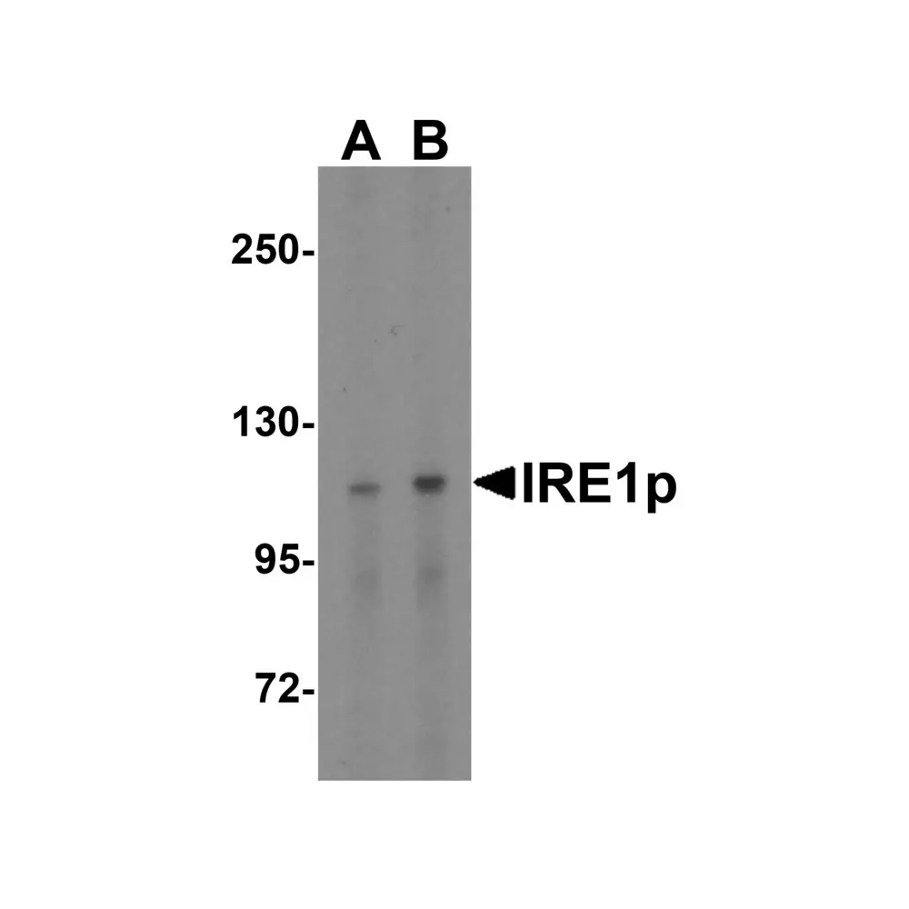 ProSci 3655 IRE1p Antibody, ProSci, 0.1 mg/Unit Quaternary Image