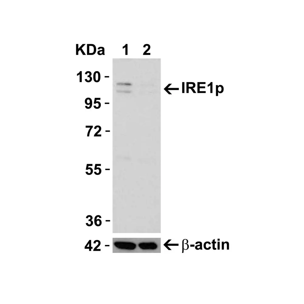 ProSci 3655_S IRE1p Antibody, ProSci, 0.02 mg/Unit Secondary Image