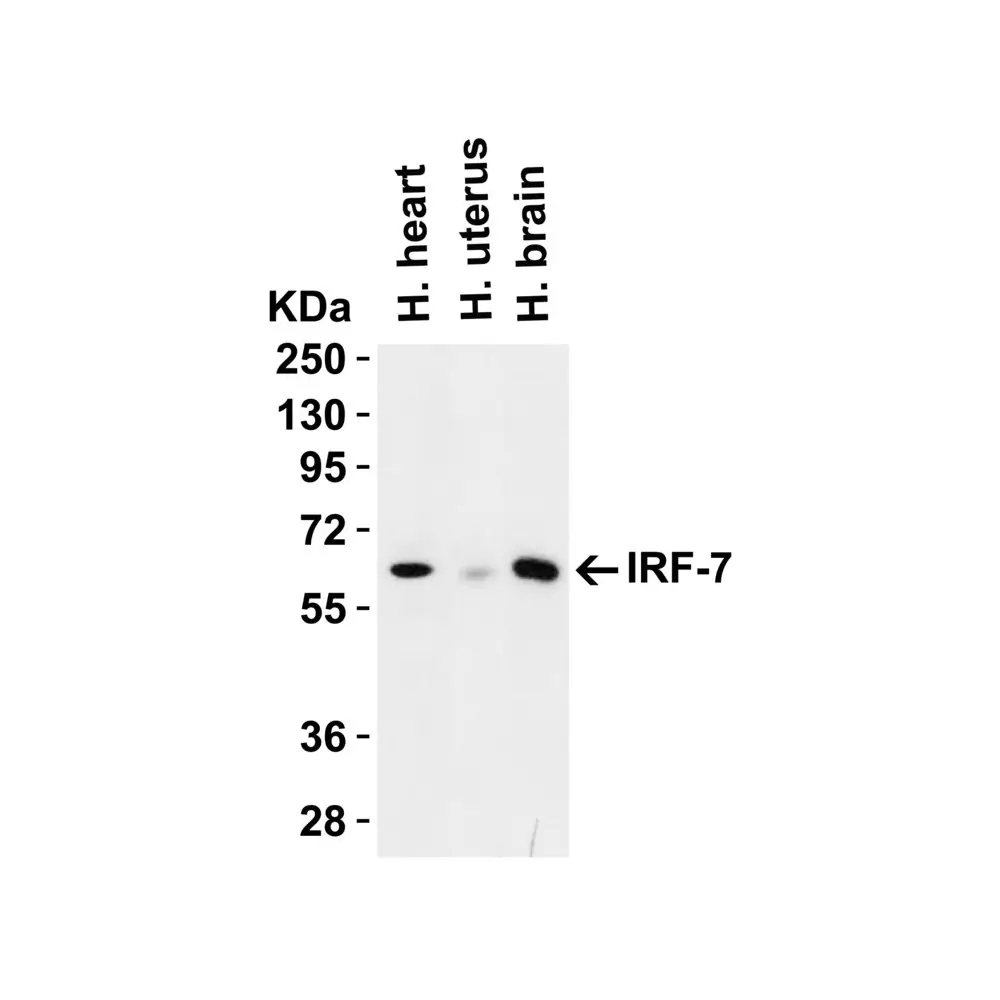 ProSci 8991_S IRF7 Antibody, ProSci, 0.02 mg/Unit Tertiary Image