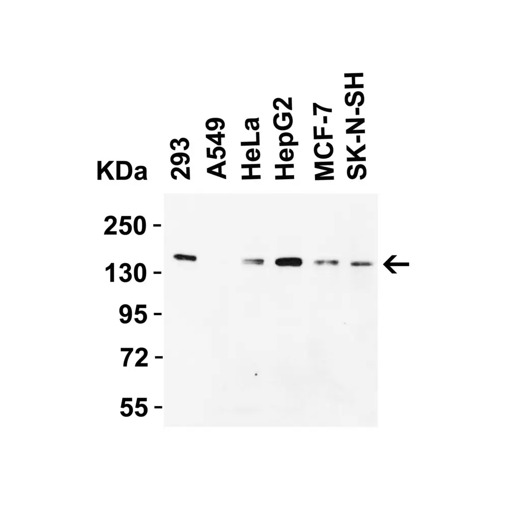ProSci 5365 JMJD1A Antibody, ProSci, 0.1 mg/Unit Primary Image