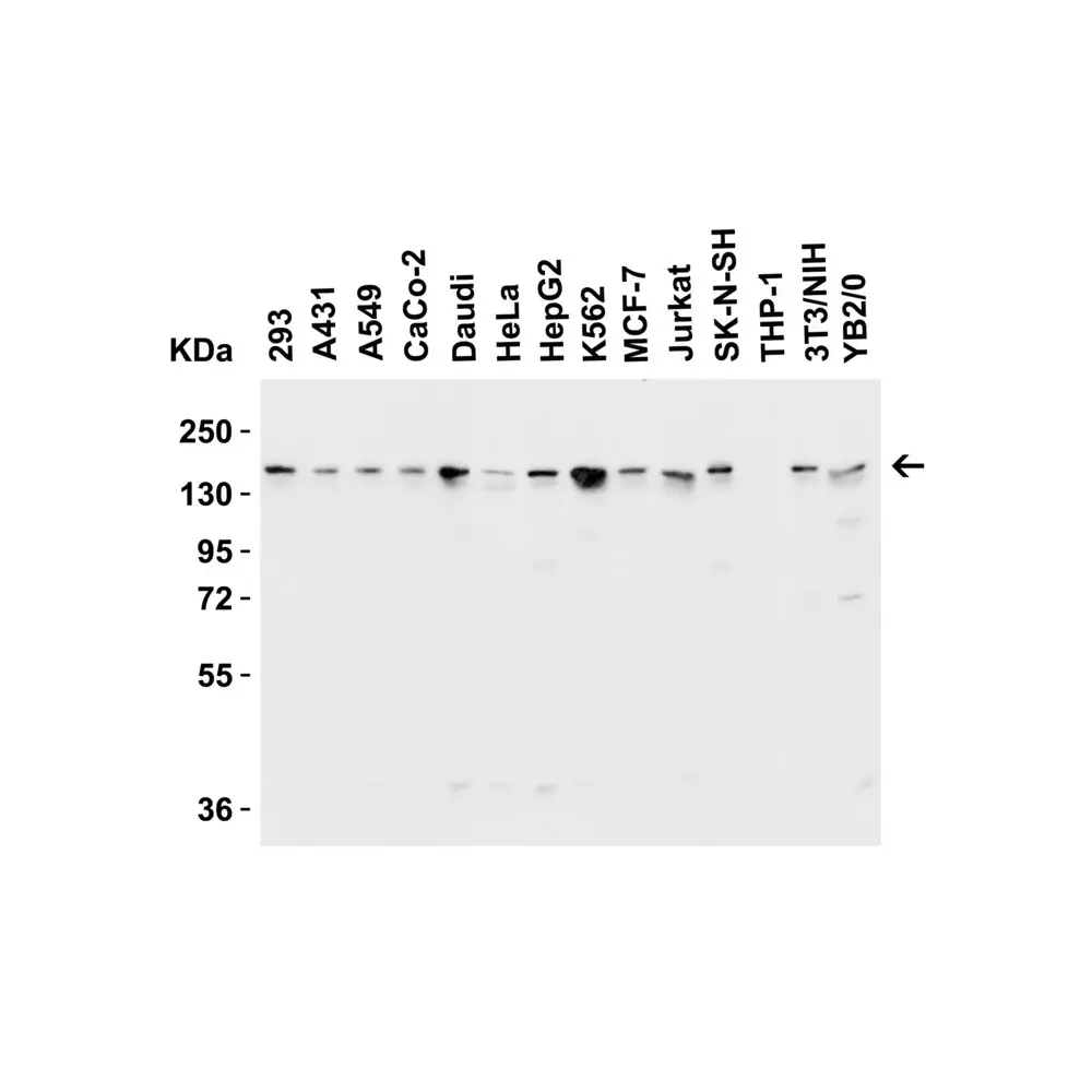 ProSci 6657_S JMJD3 Antibody, ProSci, 0.02 mg/Unit Primary Image