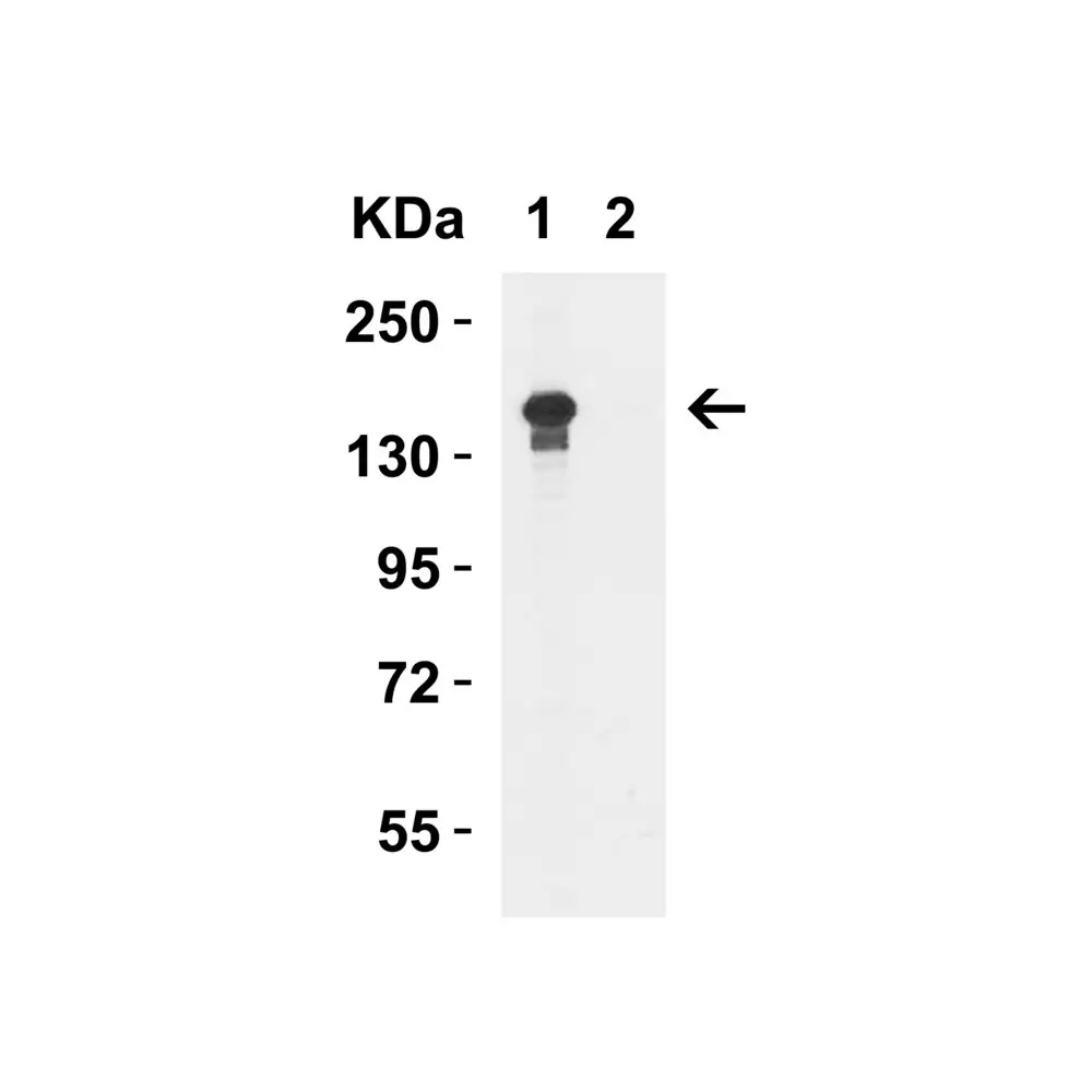 ProSci 6657 JMJD3 Antibody, ProSci, 0.1 mg/Unit Quaternary Image