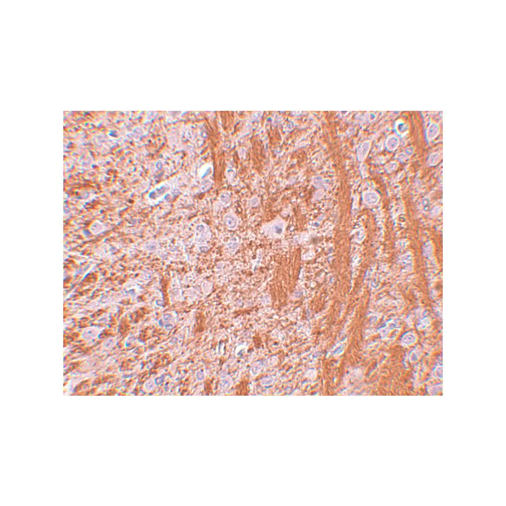 ProSci 5383_S JMJD6 Antibody, ProSci, 0.02 mg/Unit Secondary Image