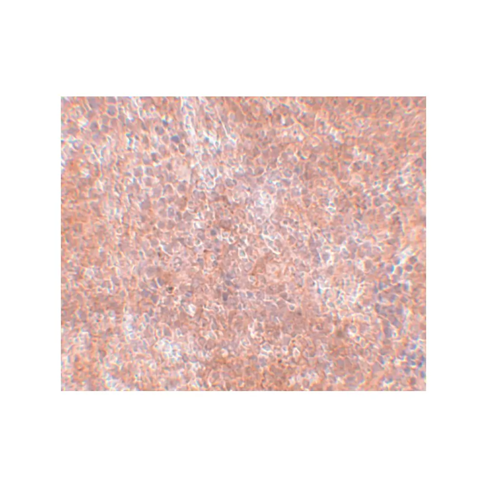 ProSci 5387_S JMJD8 Antibody, ProSci, 0.02 mg/Unit Secondary Image