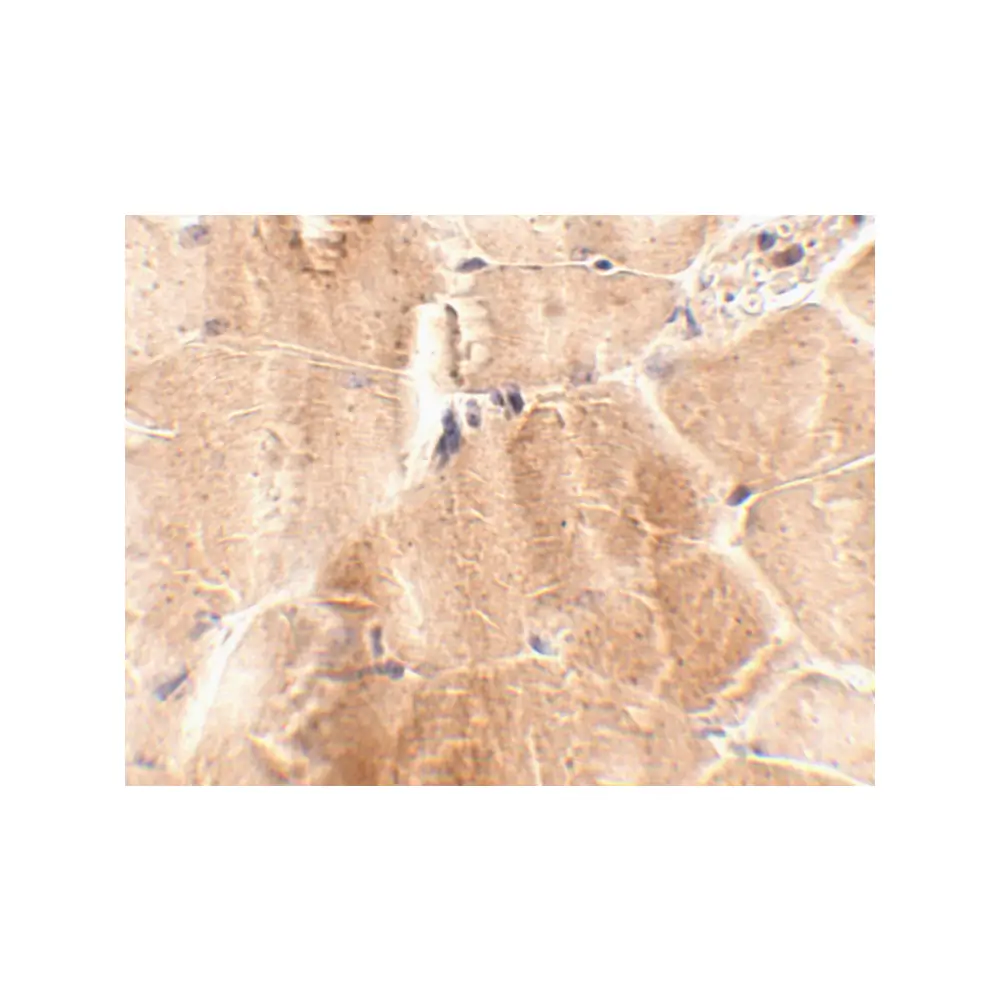 ProSci 4929 JPH2 Antibody, ProSci, 0.1 mg/Unit Secondary Image