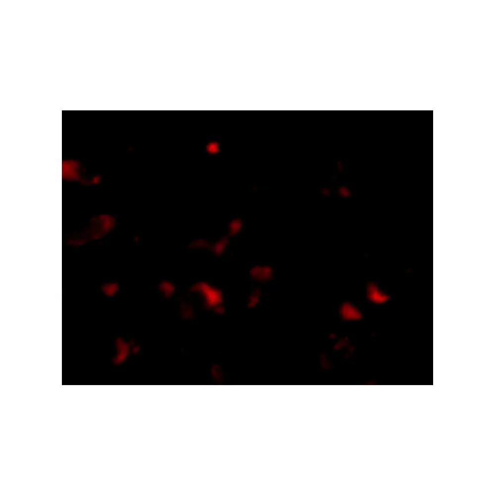 ProSci 4921 JPH3 Antibody, ProSci, 0.1 mg/Unit Tertiary Image