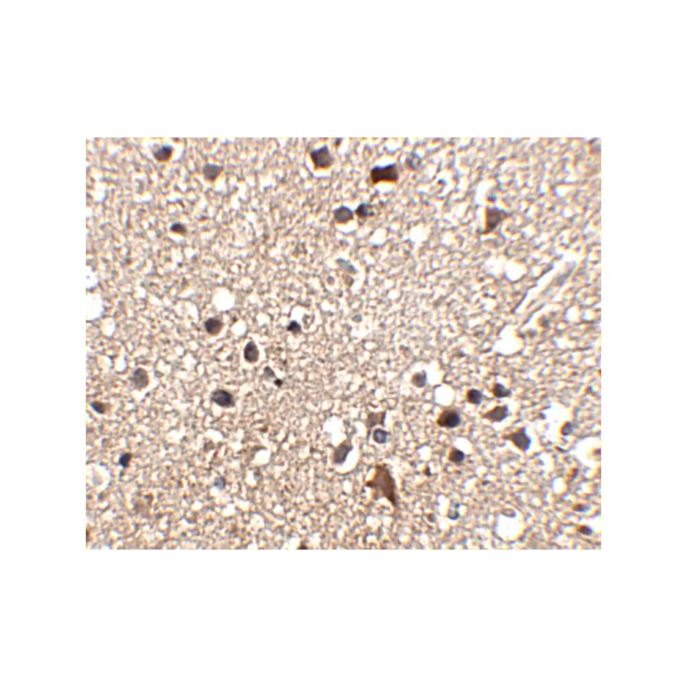 ProSci 4921 JPH3 Antibody, ProSci, 0.1 mg/Unit Secondary Image