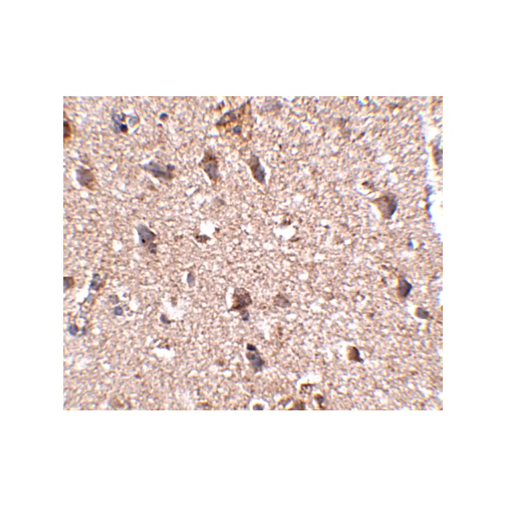 ProSci 4931 JPH3 Antibody, ProSci, 0.1 mg/Unit Secondary Image