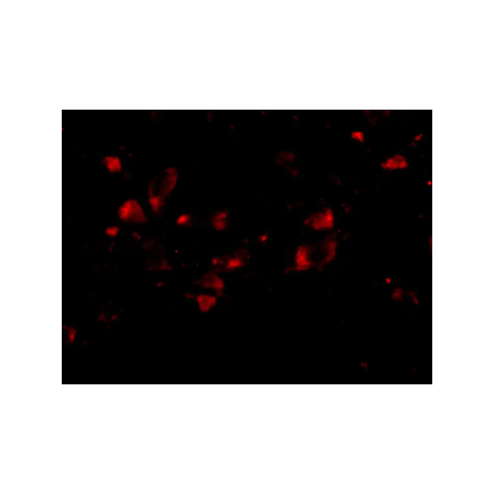 ProSci 4923 JPH4 Antibody, ProSci, 0.1 mg/Unit Tertiary Image