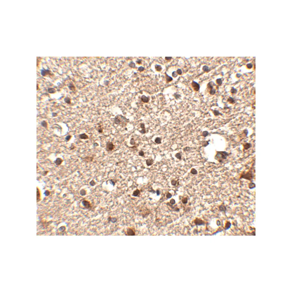 ProSci 4923_S JPH4 Antibody, ProSci, 0.02 mg/Unit Secondary Image