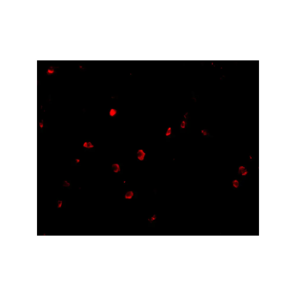 ProSci 4073 KAI1 Antibody, ProSci, 0.1 mg/Unit Tertiary Image