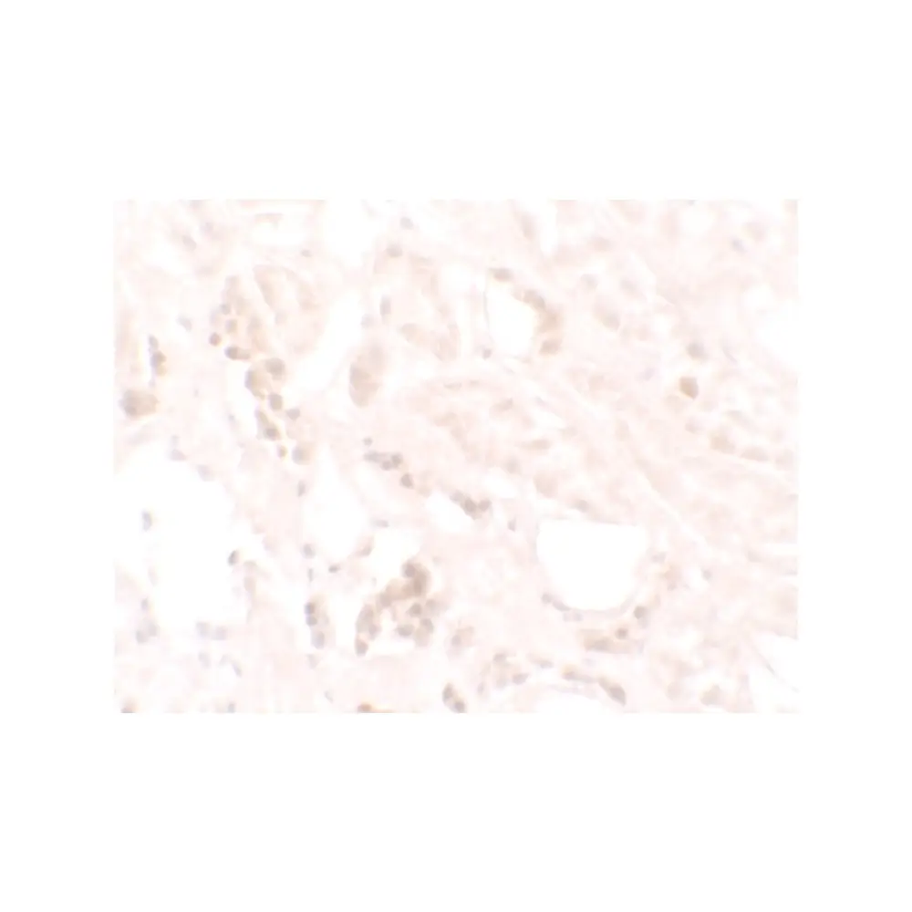 ProSci 7311_S KANK3 Antibody, ProSci, 0.02 mg/Unit Secondary Image