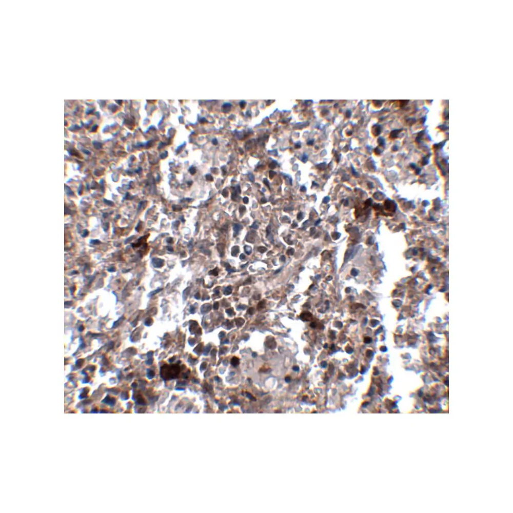 ProSci 5085 KCTD15 Antibody, ProSci, 0.1 mg/Unit Secondary Image