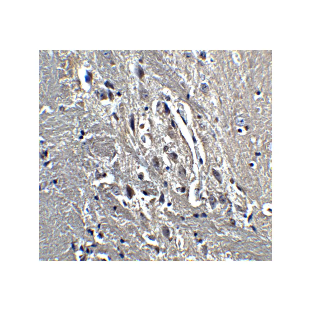 ProSci 4289 KIF5 Antibody, ProSci, 0.1 mg/Unit Quaternary Image