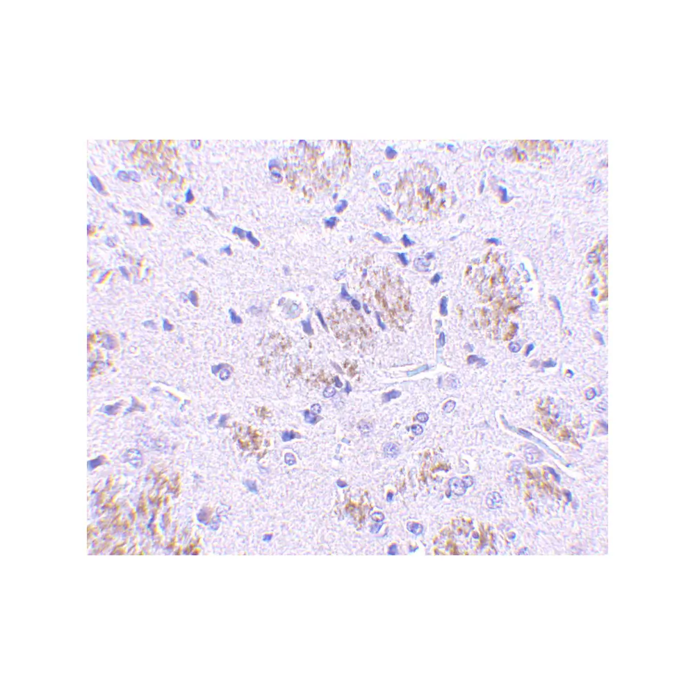 ProSci 3015 KLHL1 Antibody, ProSci, 0.1 mg/Unit Secondary Image