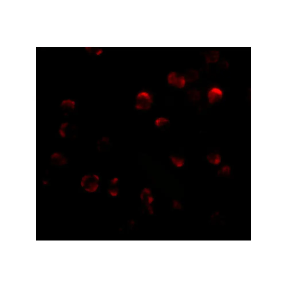 ProSci 5223_S KLHL15 Antibody, ProSci, 0.02 mg/Unit Tertiary Image