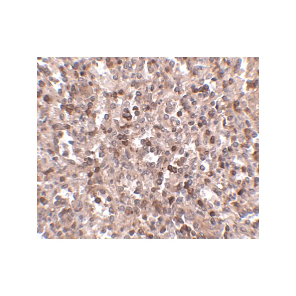ProSci 4989 KLRA1 Antibody, ProSci, 0.1 mg/Unit Secondary Image
