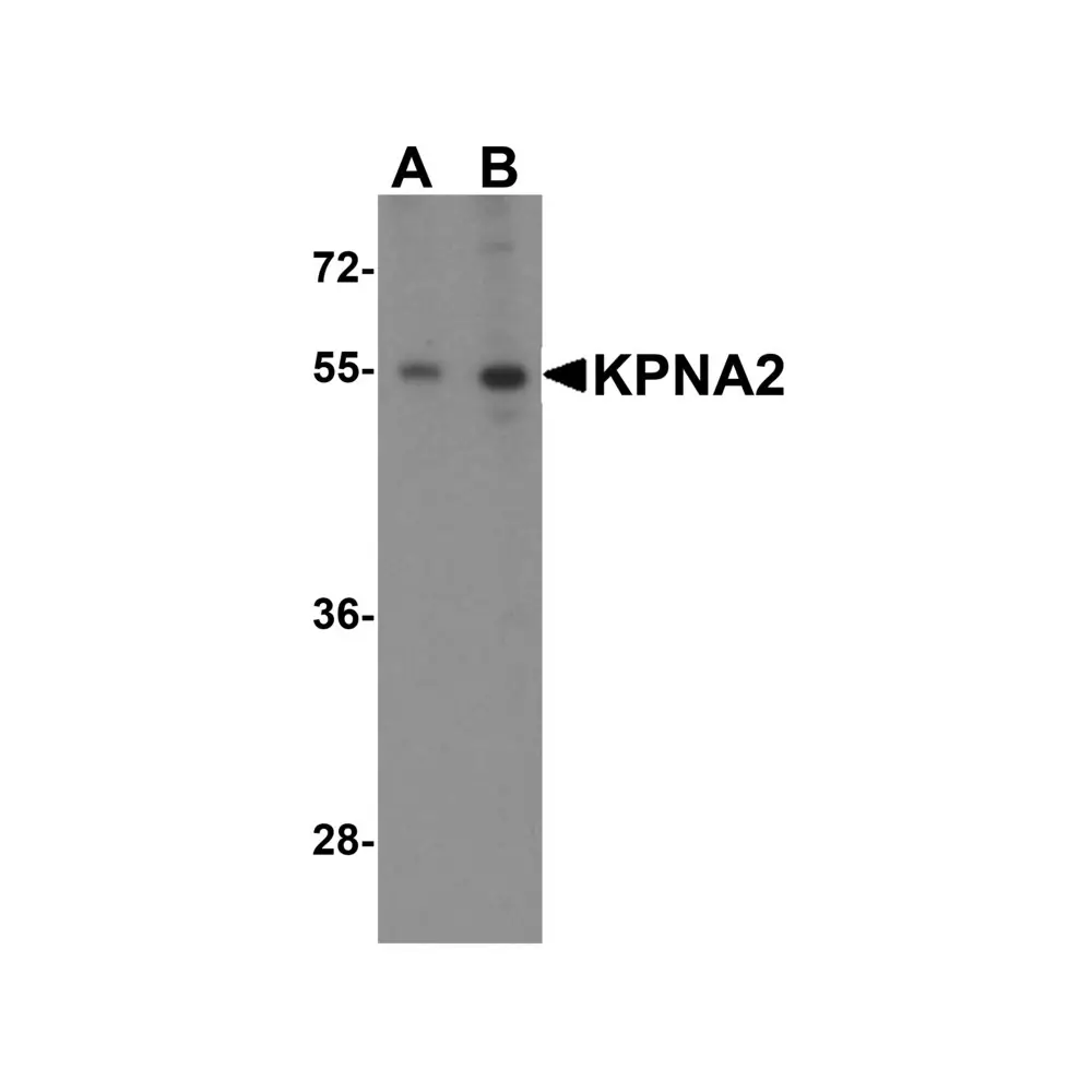 ProSci 5983 KPNA2 Antibody, ProSci, 0.1 mg/Unit Quaternary Image