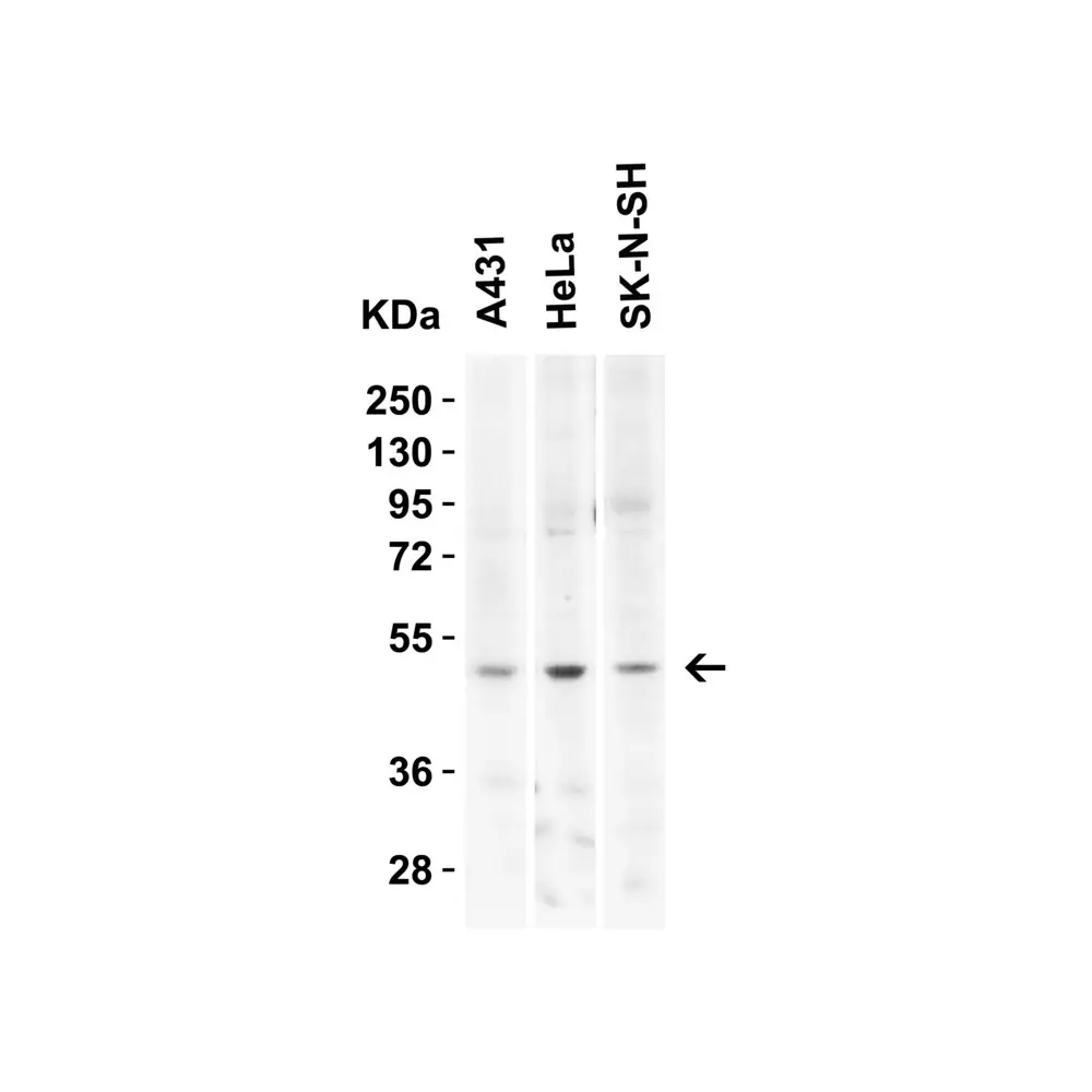 ProSci 7263 KREMEN2 Antibody, ProSci, 0.1 mg/Unit Secondary Image