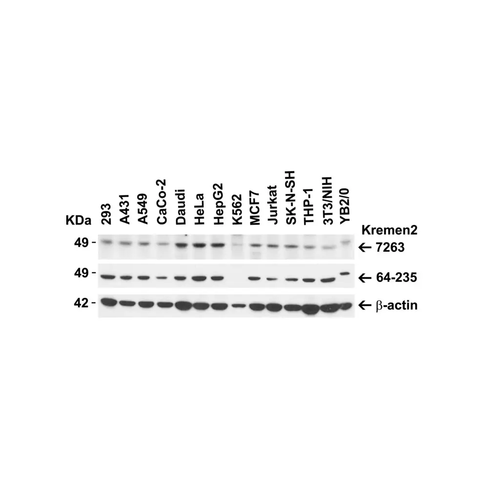 ProSci 7263_S KREMEN2 Antibody, ProSci, 0.02 mg/Unit Primary Image