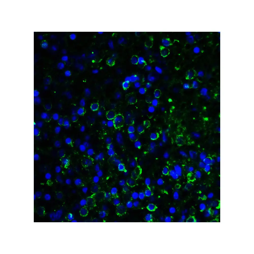 ProSci RF16089 LAG3 Antibody [1G4], ProSci, 0.1 mg/Unit Quaternary Image
