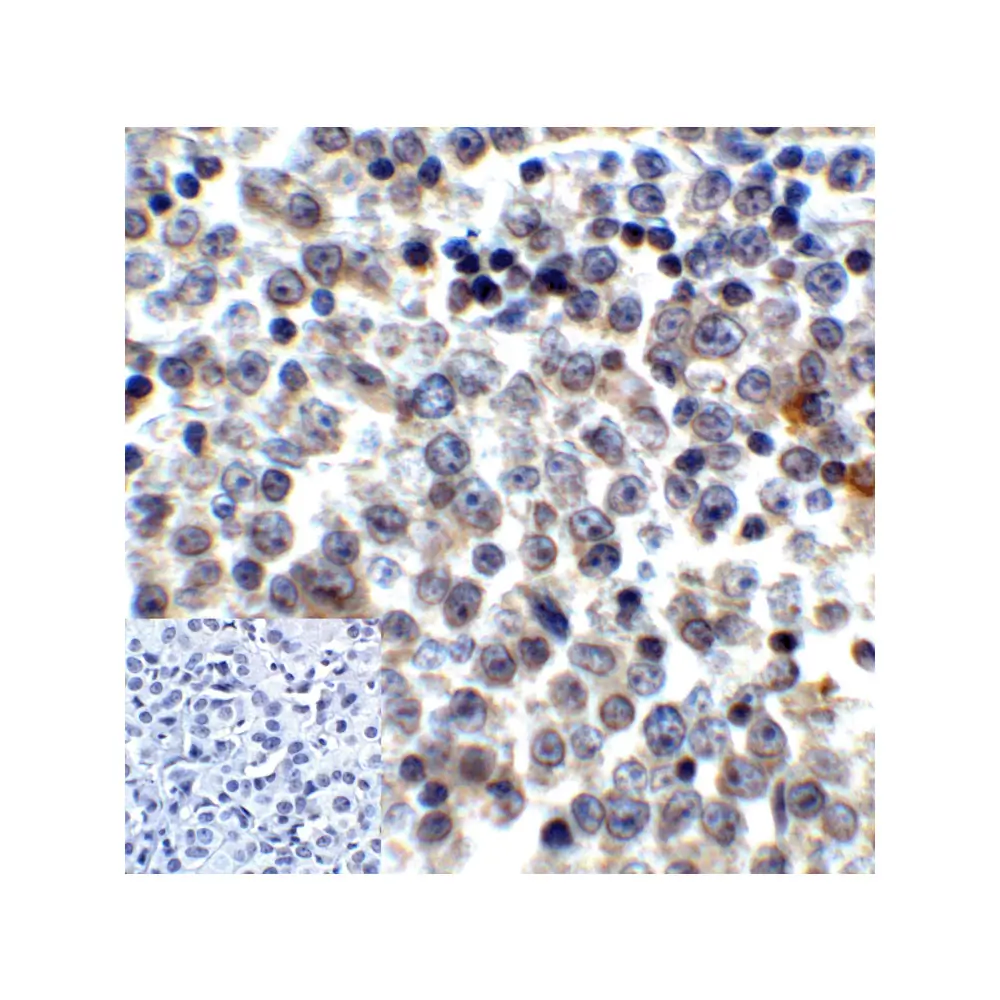 ProSci RF16087 LAG3 Antibody [6D1], ProSci, 0.1 mg/Unit Quaternary Image
